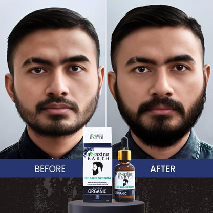 Amazing Earth Beard Hair Growth Serum (30 ML)