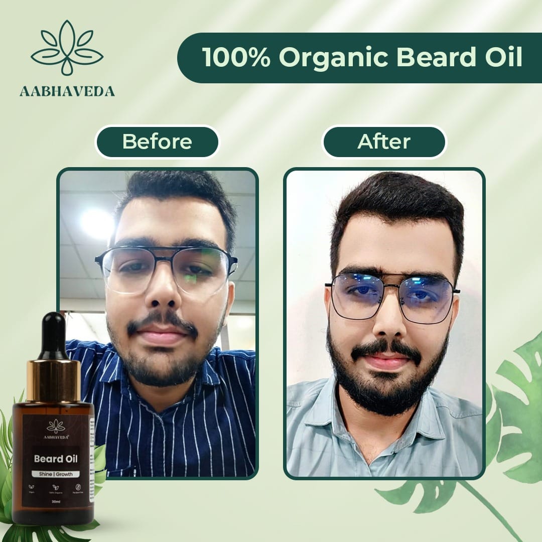Aabhaveda Beard Oil (30 ML)
